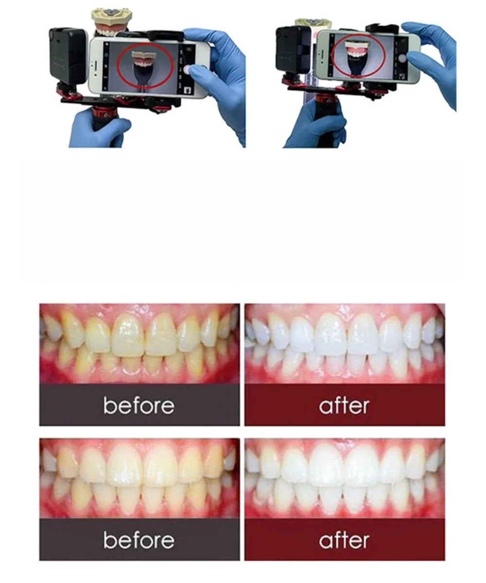 Dental oral LED mobile phone fill light beautification shooting effect used for macro, manicure, dentistry, makeup photography