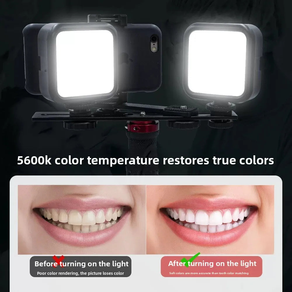Oral Photography Light, Portable Bluetooth LED Lamp for Dental Intraoral Shooting, Handheld Fill Light for Mobile Phone Camera
